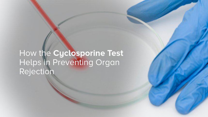 How the Cyclosporine Test Helps in Preventing Organ Rejection